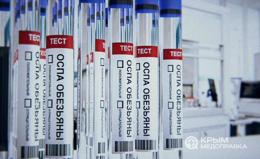 Система тестирования на выявление оспы обезьян