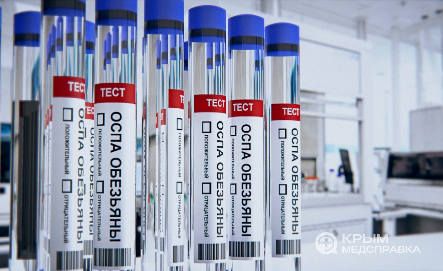 Тест-системы для выявления оспы обезьян
